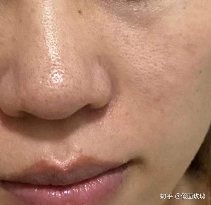 近距离看皮肤状态真的很糟糕了tt