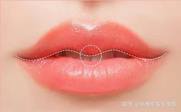 我没有好看的颜值,但是我有性感的唇