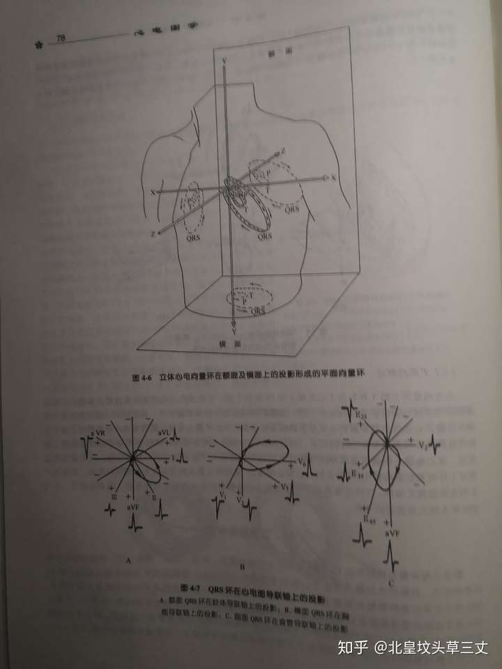 心电向量图与心电图的关系
