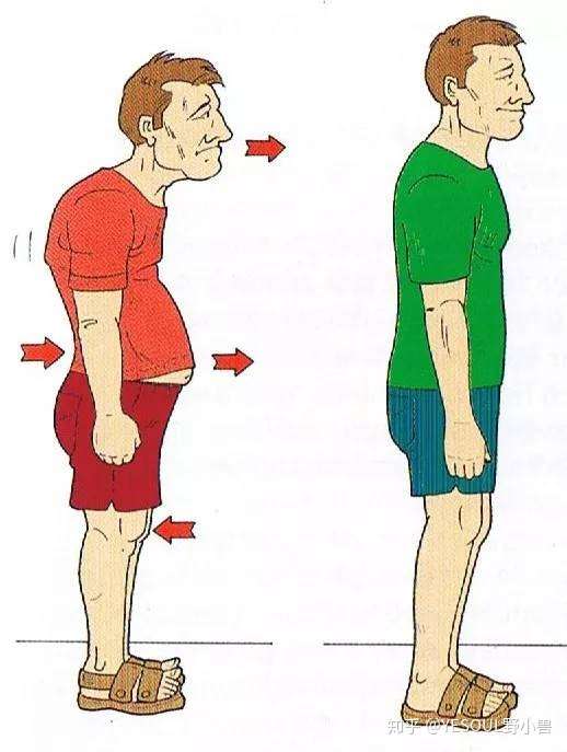怎样纠正成年人驼背,耸肩的体态?