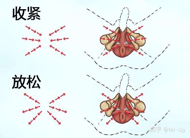 男人如何使用凯格尔训练法