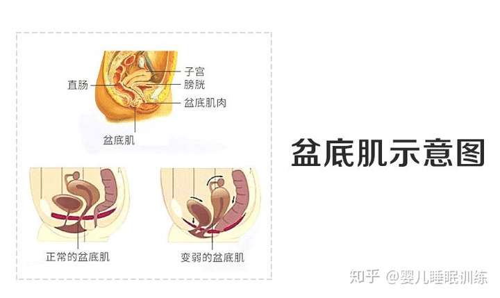 达到盆地的肌肉进行一个很好的锻炼和回复的过程 如何去做盆底肌锻炼
