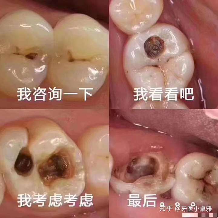 满口蛀牙 但是家里经济不好怎么办?