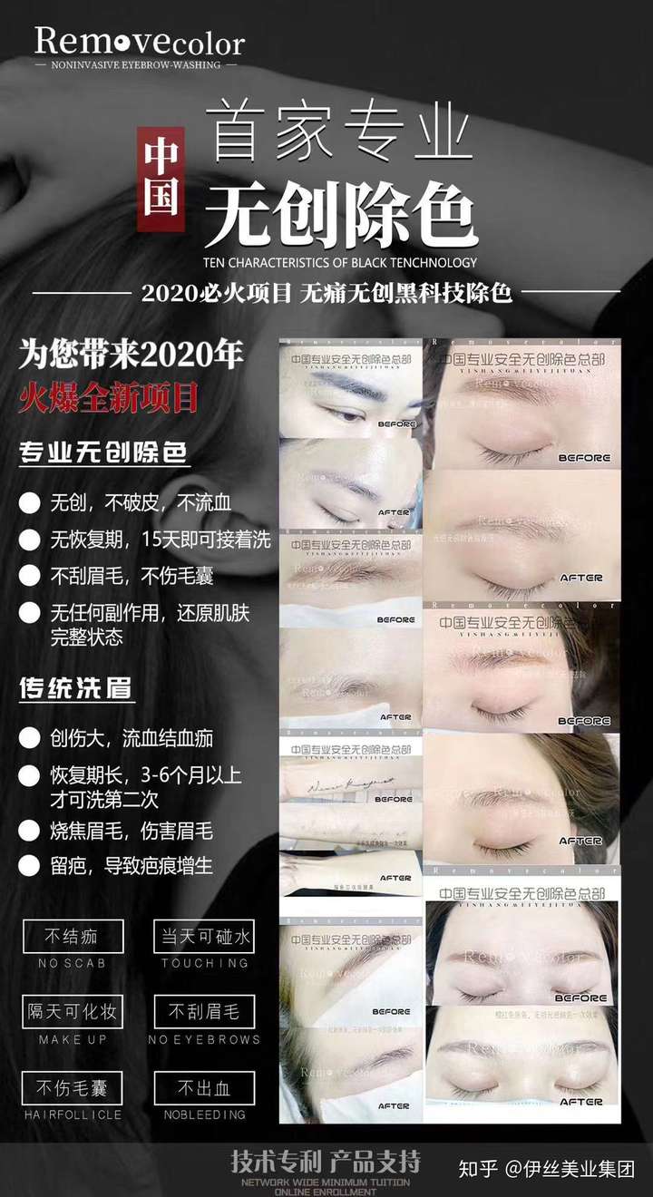 什么是黑科技无创洗眉无创洗与传统洗皮秒洗眉的区别