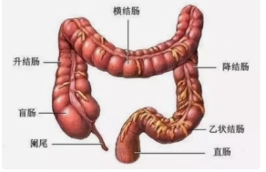 2/3的结直肠癌发生于左部,包括:横结肠远端1/3,降结肠,乙状结肠,直肠.