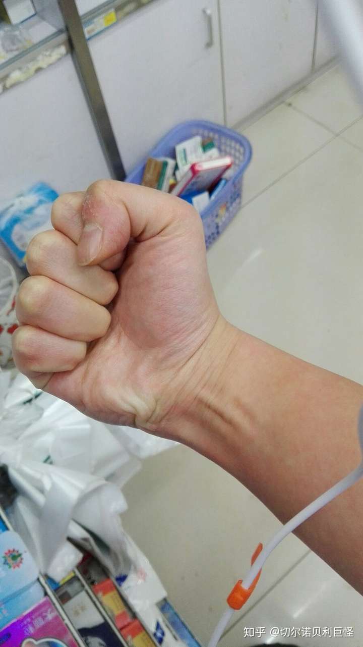 为了避免有人觉得我吹牛,我给你们看下我沙包大的拳头和胳膊吧