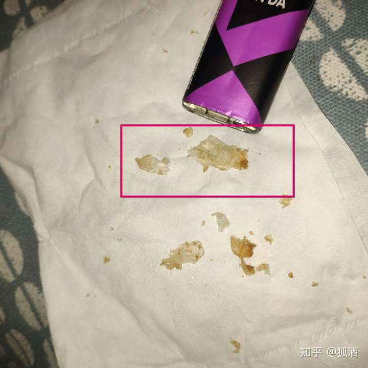 耳屎能大到什么程度?