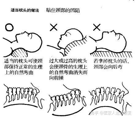 枕头的形状 颈椎有明显弧度,枕头也应该有与颈椎相匹配的弧度.