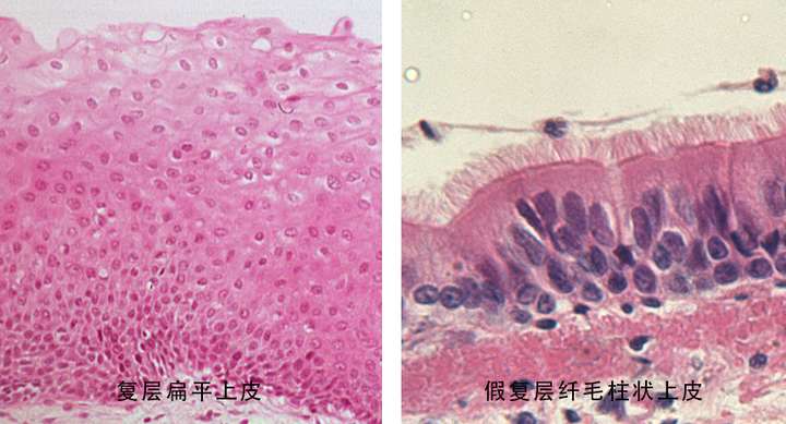 鼻腔黏膜属于假复层纤毛柱状