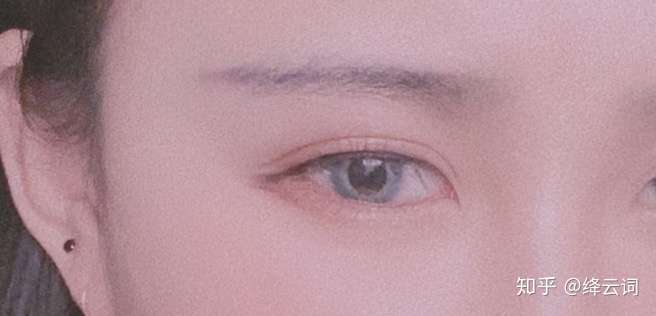 眼尾天生笑起来很挑的一道鱼尾纹,很崩溃,能预料以后一定比同龄人更显