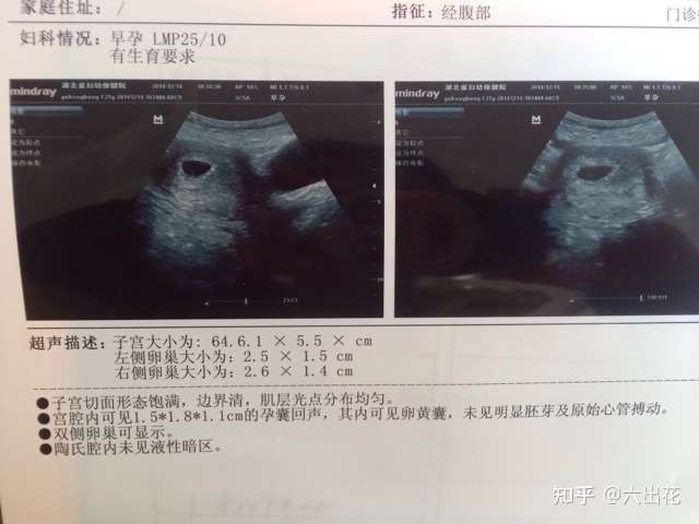 阴道b型超声最早在4~5周就可以检测到孕囊.