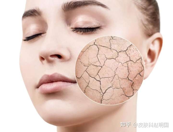 脸摸起来粗糙,感觉干干的有点痒,但是看起来什么都没长是什么原因啊