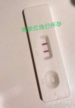 怎么判断是否怀孕?