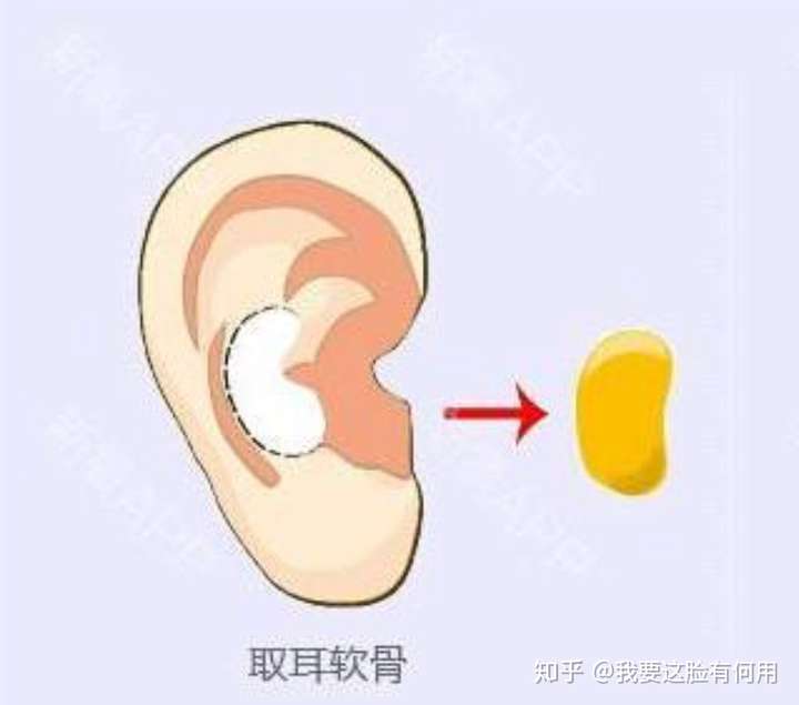 耳软骨是耳朵上的软骨,一般在这个位置.