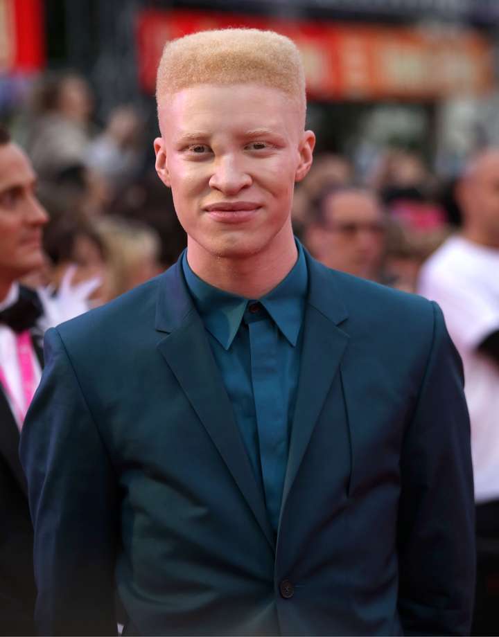 比如白化病的黑人模特shaun ross