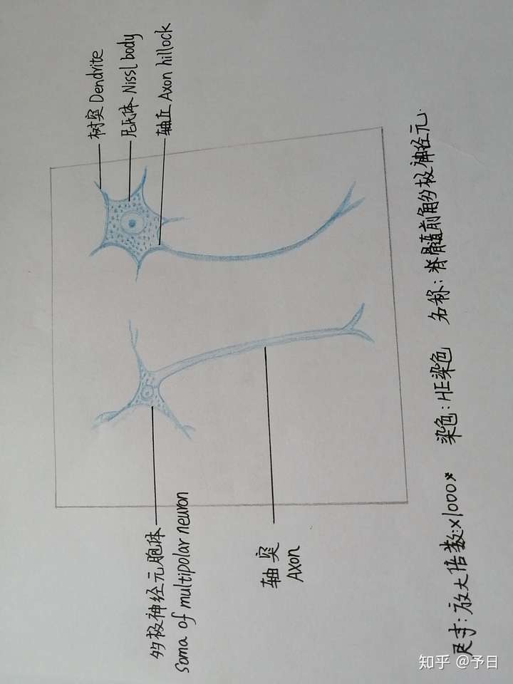 血细胞 脊髓前角多级神经元 脊