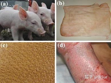 医院回应「猪躺手术台被剥皮移植」,称猪皮将用于覆盖