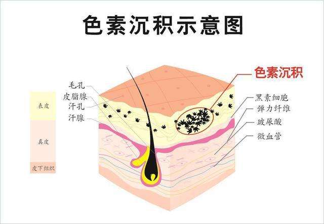 有没有好的护肤品推荐呢,想要美白淡斑的?