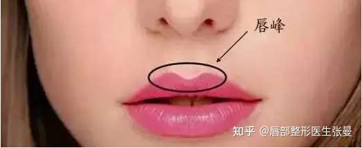 嘴巴没有唇峰怎么办?