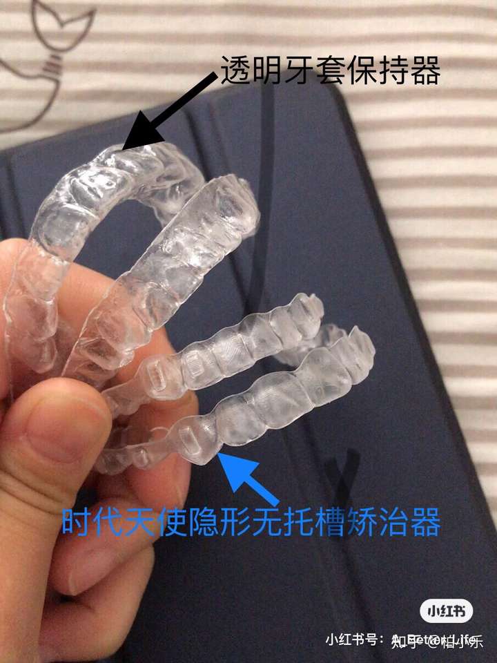 但矫正反弹这不太容易出现在隐形无托槽矫正患者的身上,因为隐形无