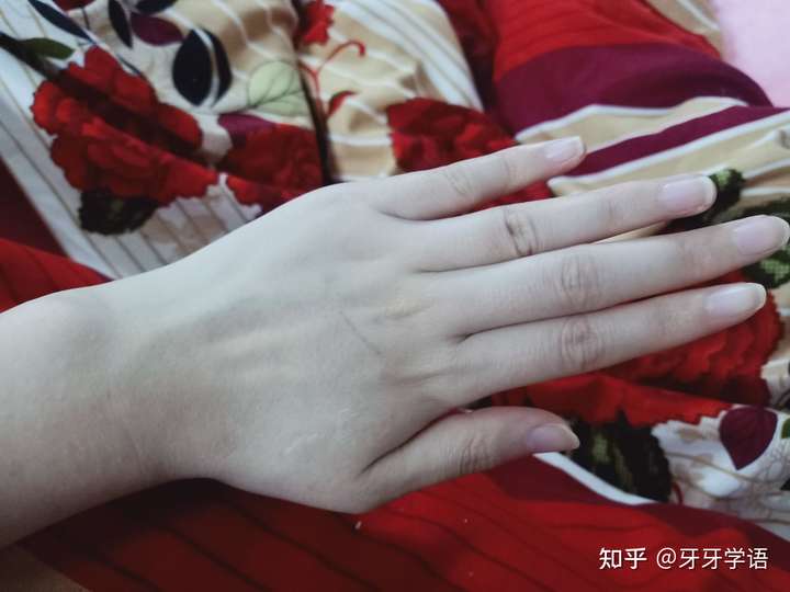 5cm,不知道为什么中指不一样长,明明其他手指都差不多的