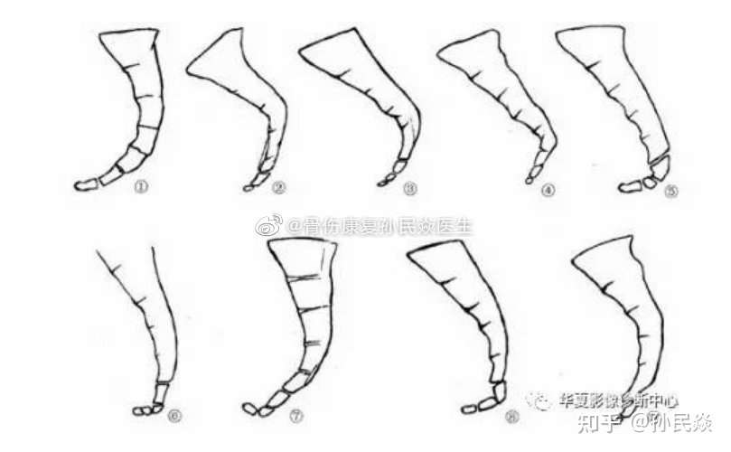 孙民焱 的想法 今日工作心得 钩状尾椎 hooked coccyx 一 知乎