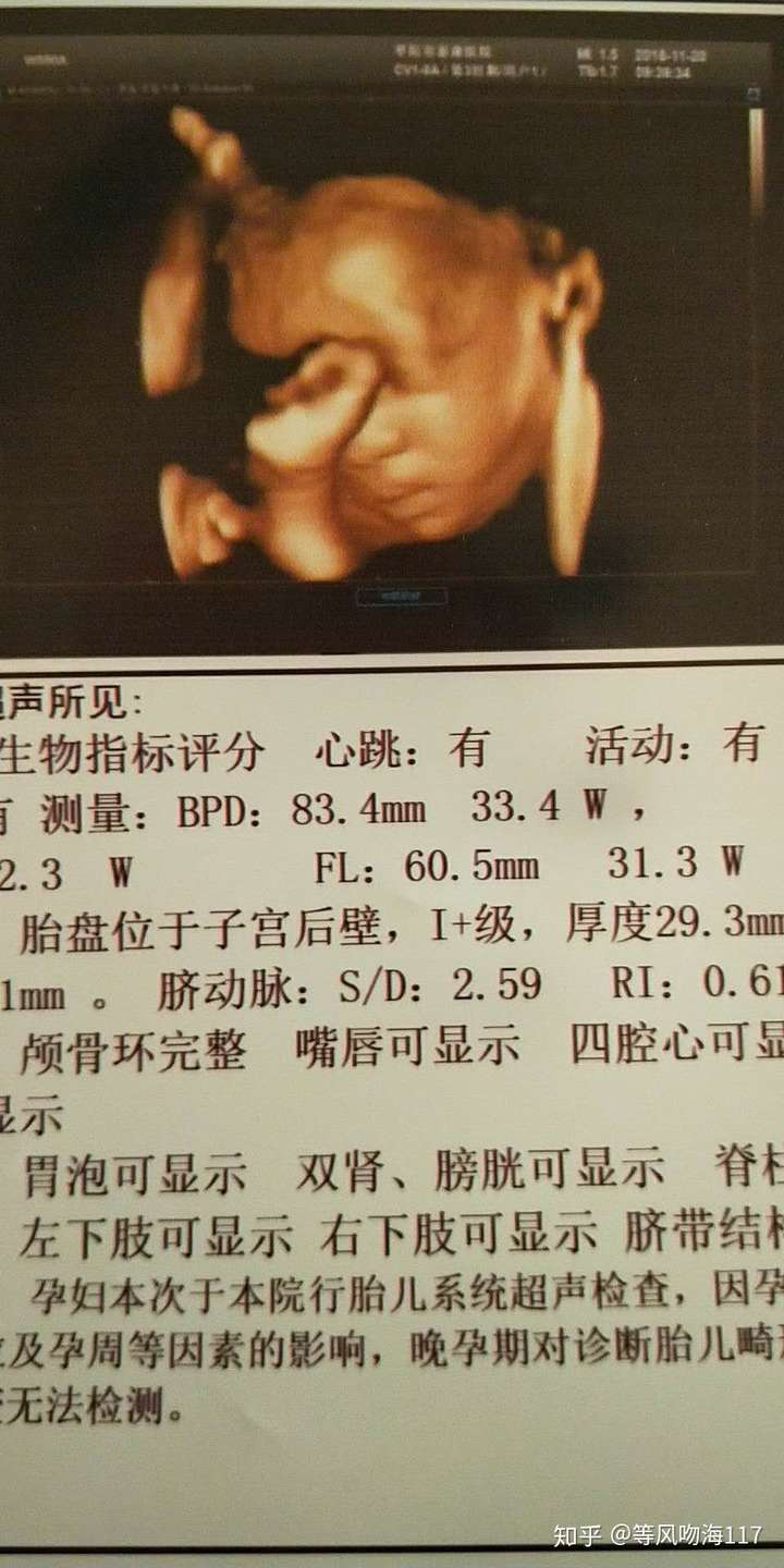你第一次看到宝宝的四维彩超照片,是什么感觉?