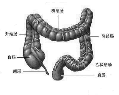 「直肠癌」的症状是怎样的,如何预防或治疗?