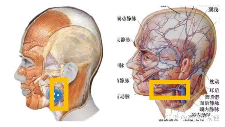 左图为下颌升支后缘出血点(咬肌动脉);右图为下颌下缘出血点(面动脉