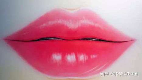 嘴唇薄唇峰不明显适合做m唇吗?