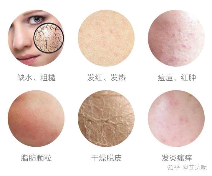 我只是想删掉这个问题?