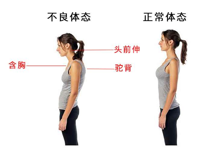 详细讲,就是: 头颈向前 下段颈曲变直或反弓 上段前凸增加 圆肩 胸椎