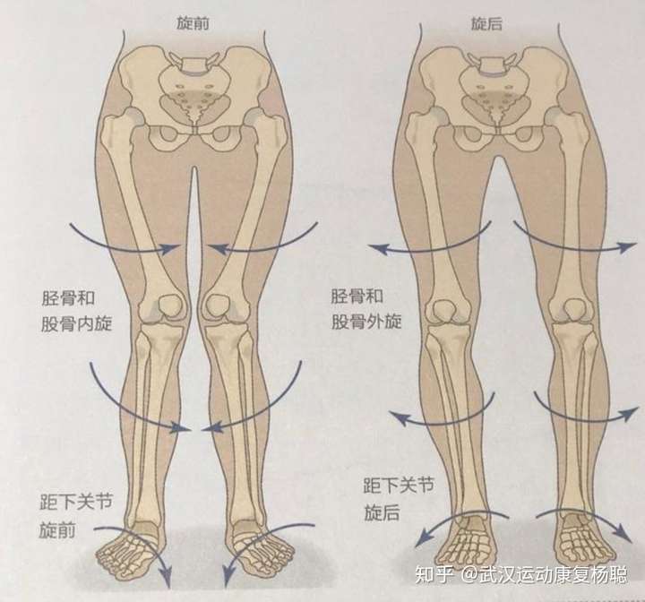 力线改变,受伤后综合导致,还有就是骨盆前倾后倾等一系列下交叉综