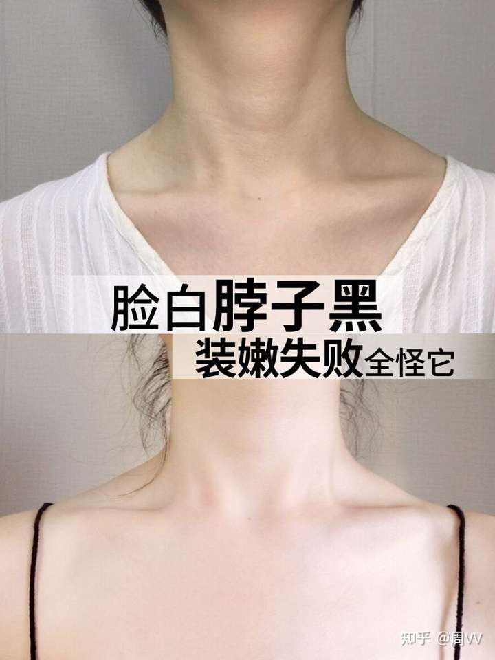 脖子黑?脖子与脸肤色差异大怎么办?