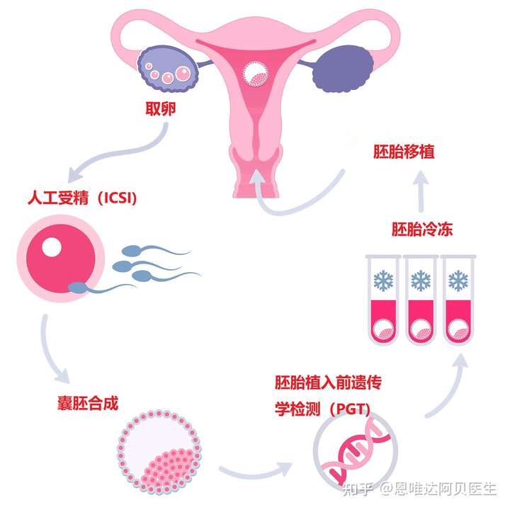 从上图人工授精的过程以及是试管婴儿技术的流程,就可以清楚的看到