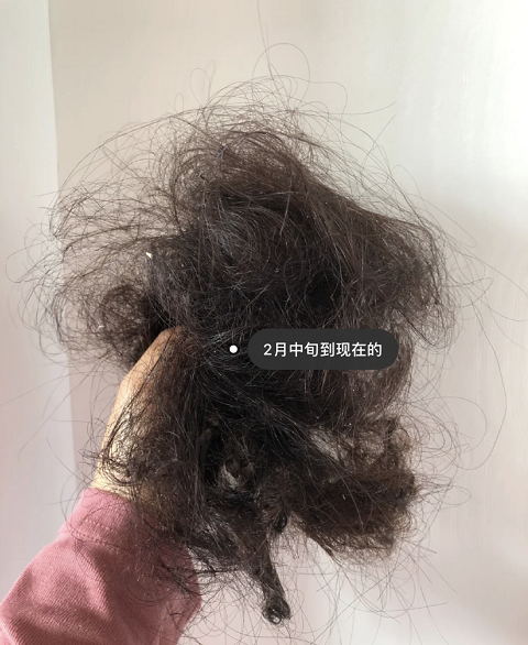 油性发质,而且掉头发,一般一天洗一次头发,用什么洗发