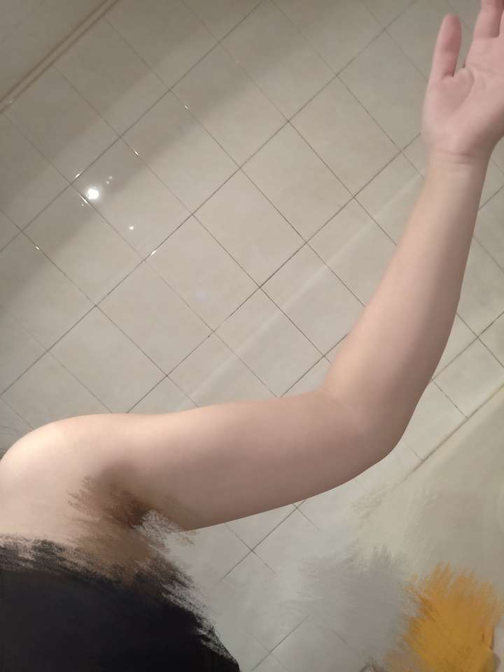 有什么方法能快速减手臂肌肉?
