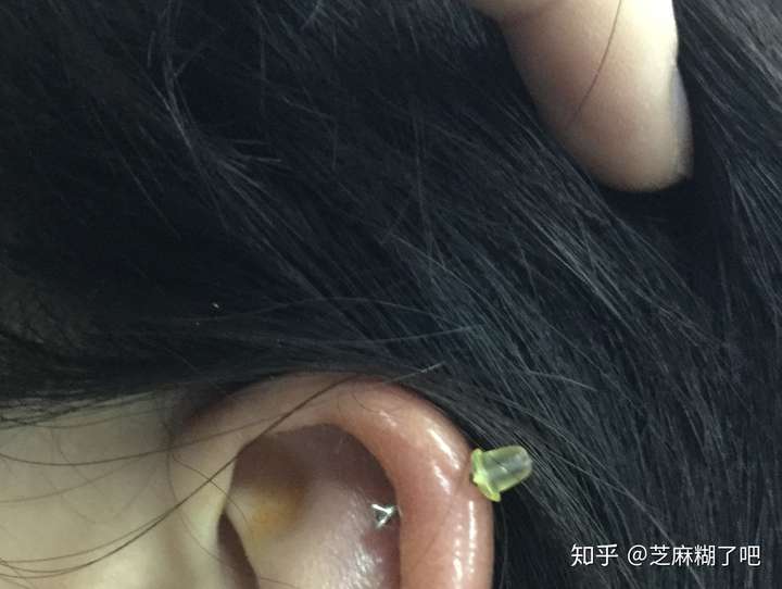 厚耳垂刚打耳洞能戴耳圈吗?