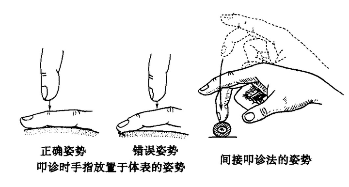 下午临床诊断学实验课上叩诊.