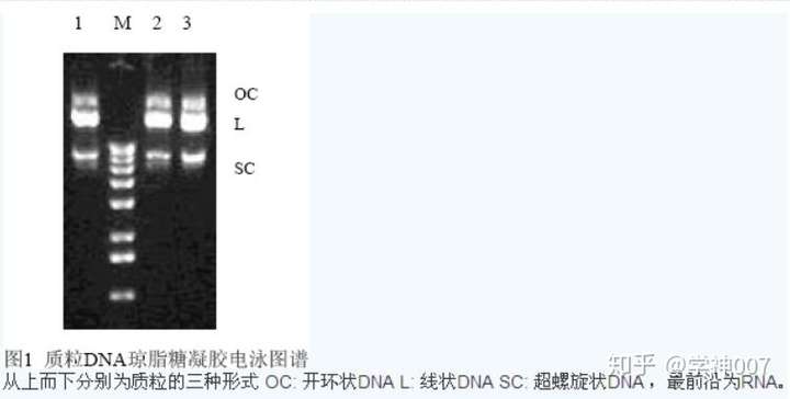 10000的marker的电泳图,dnamarker5000电泳图 质粒dna电泳出的两条带分别是什么?位置关系是怎样的?