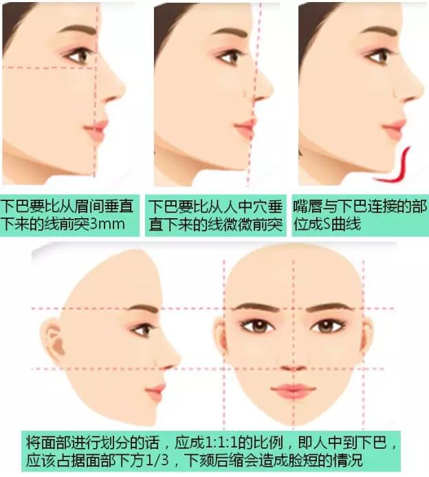 大家每天多做下颌骨也就是下巴的前伸后缩运动,首先把下颌关节活动开