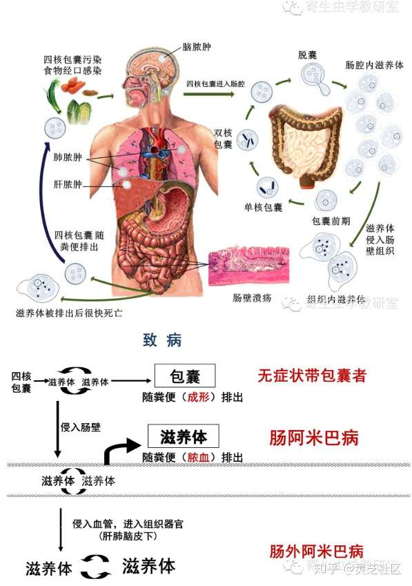 起病突然或隐匿,可呈暴发性或迁延性,可分成肠阿米巴病和肠外阿米巴病