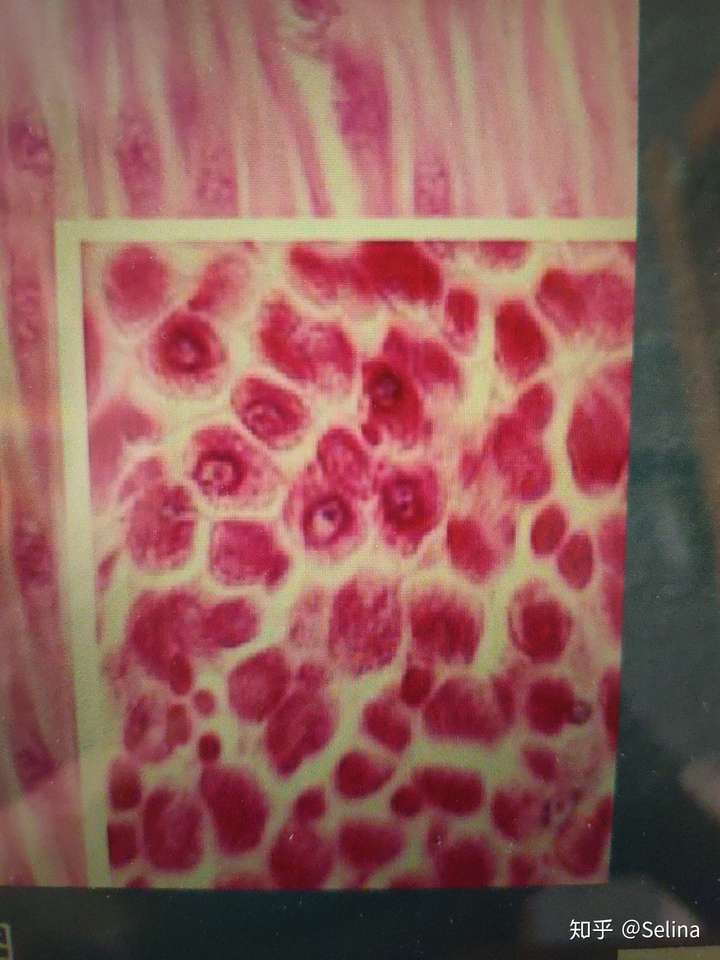 横切时,平滑肌纤维与心肌纤维怎么区别?