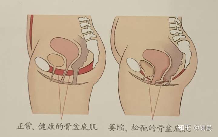 产妇刚生完孩子,盆底肌怎么恢复和锻炼?