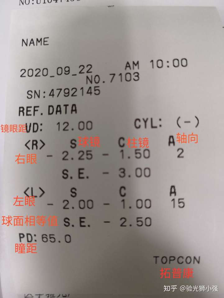 有没有眼科医院工作或者懂这方面的,帮忙告知我这个验光单上的数据.