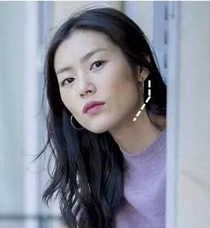 怎么判断自己脸大是咬肌大还是骨头大?