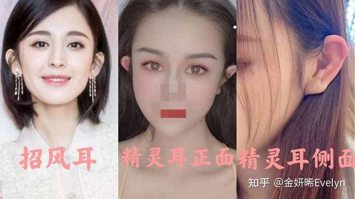 为什么最近开始流行精灵耳整容,是一种容貌焦虑吗?