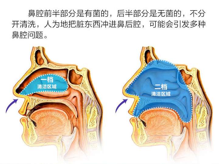 我是资身鼻炎患者了(从高中开始.