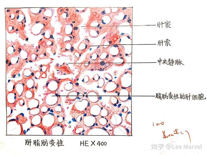 为什么咱们不弄个病理红蓝手绘图的问题呢?