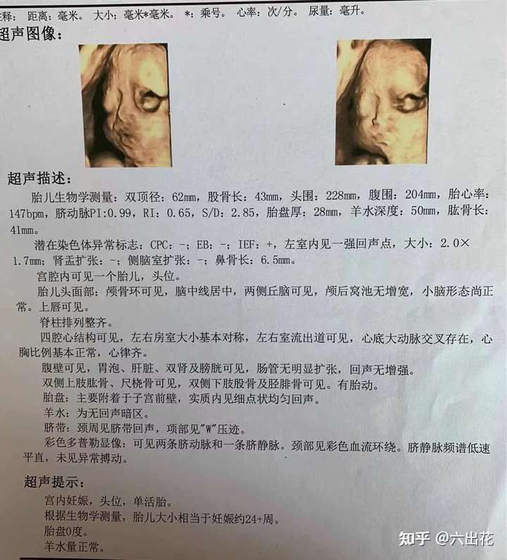 怀孕多久可以做三维彩超?